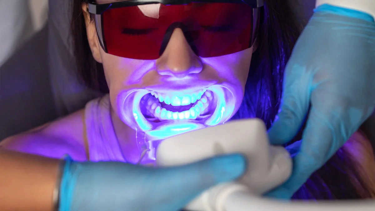 Laserul dentar: beneficii și utilizări în tratamente