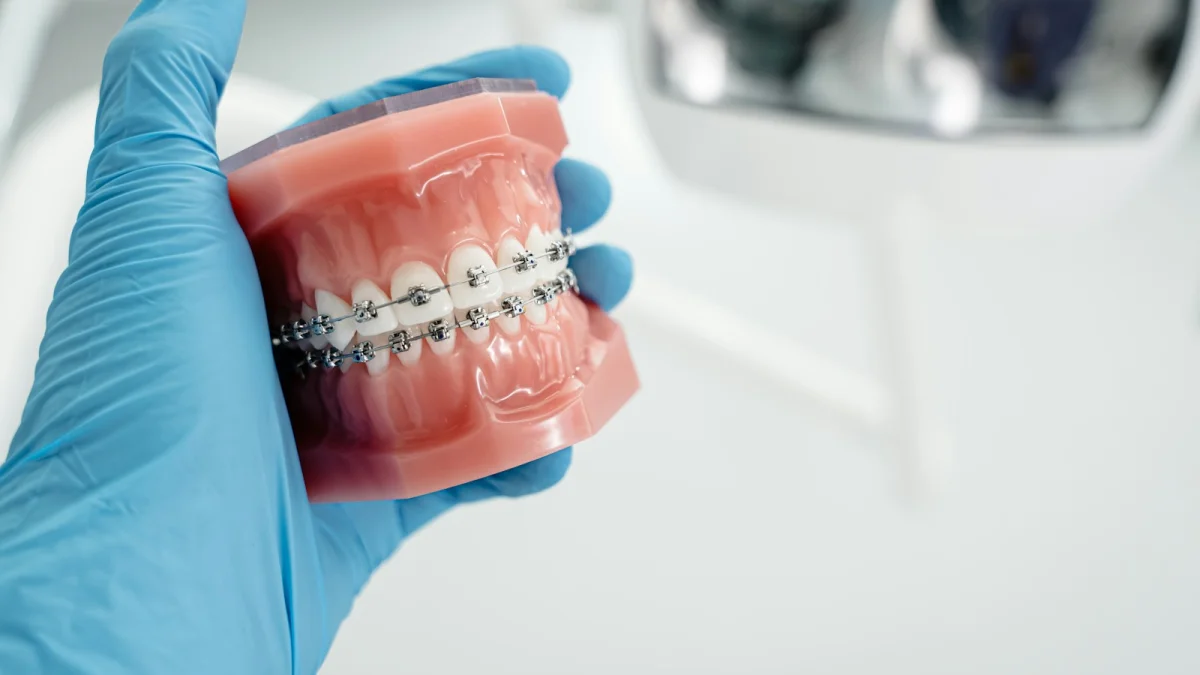 Proteză dentară: tipuri și recomandări