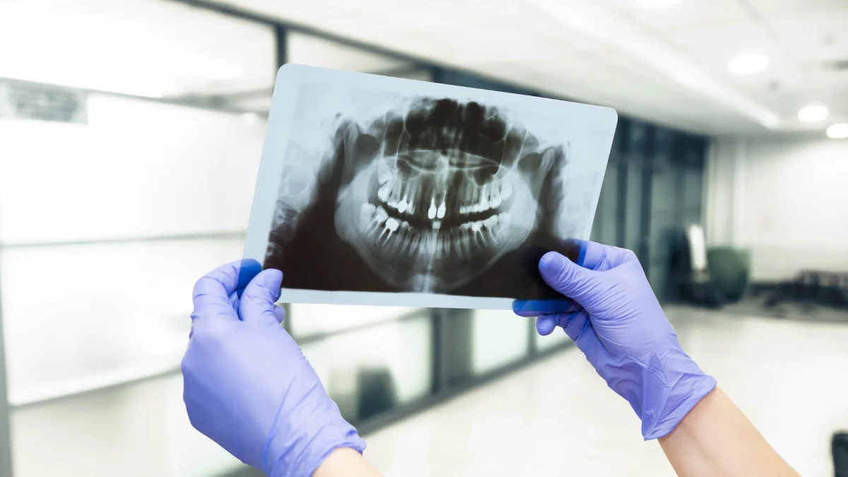 Radiografie dentară: tipuri și când este necesară